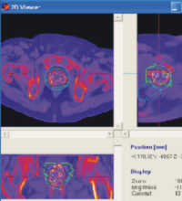 Postplanning using DICOM images in 2D mode
