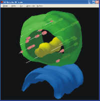 Transparent 3D presentation of the prostate allows viewing the seed distribution