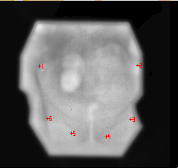 Portal treatment image with fiducial points