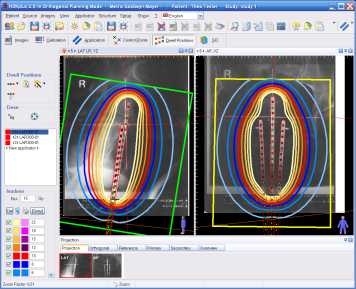 The graphical user interface is designed to meet XP standards